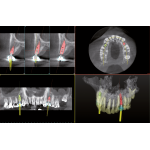 *I-Max 3D Nueva Generación